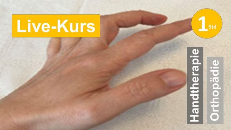 Sie sehen einen Handrücken mit leicht gebeugten Fingern als Assoziation zum Webseminar über Nervus Ulnaris Verletzungen für Ergotherapie + Physiotherapie in der Rehabilitation peripeheren Nervenläsionen in der Handreha in Klinik + Praxis