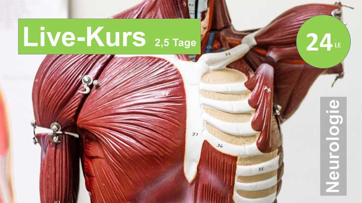 Sie sehen den Torso eines anatomischen Muskelmodells als Assoziation zum Webseminar für Ergotherapie + Physiotherapie in der neurologischen Rehabilitation bei Schlaganfall + Apoplex in Klinik + Praxis