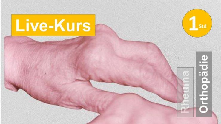 Sie sehen Hände mit Rheuma als Assoziation zum Webseminar für Ergotherapie + Physiotherapie in der Rehabilitation  von Handgelenk und Erkrankung der Metacarpale bei Erkrankungen im polyarthritischen Formenkreis in Handreha + Ortho in Klinik + Praxis