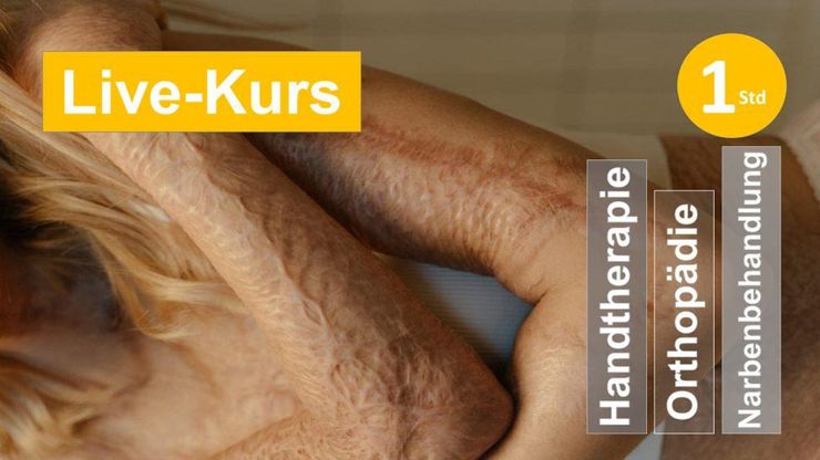 Sie sehen eine großflächig verwachsene Narbe am Oberarm + Schulter als Assoziation zum Webseminar über komplexe Narben und ihre Entstehung + Therapie für Ergotherapie + Physiotherapie in der HandReha und Orthopädie in Klinik + Praxis